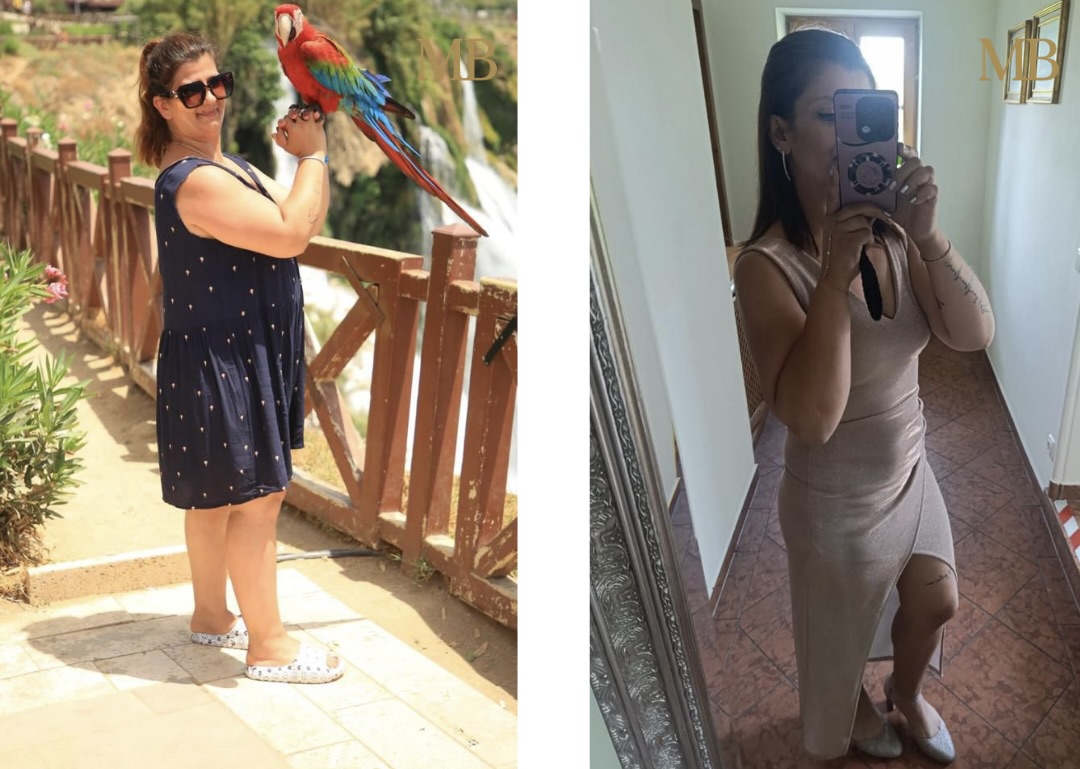 Transformation Derya